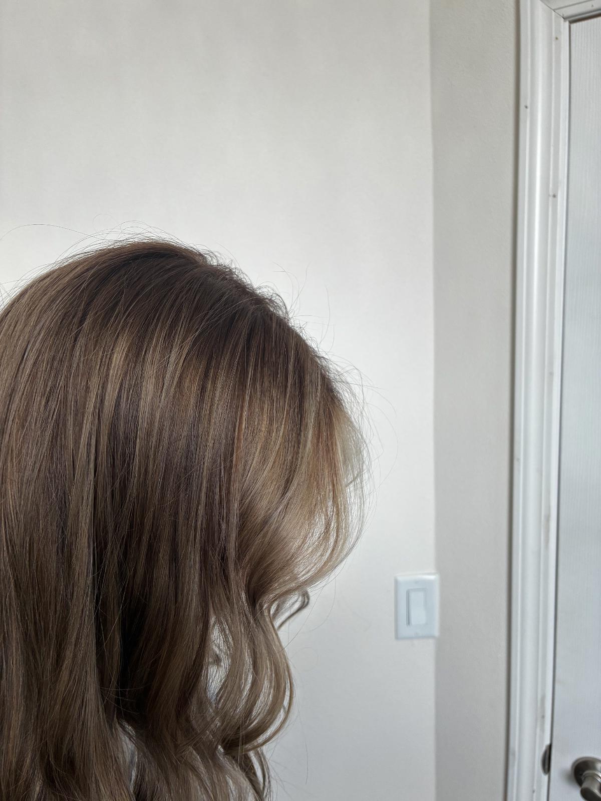unnamed image